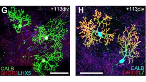 Growing functioning brain tissue in 3D