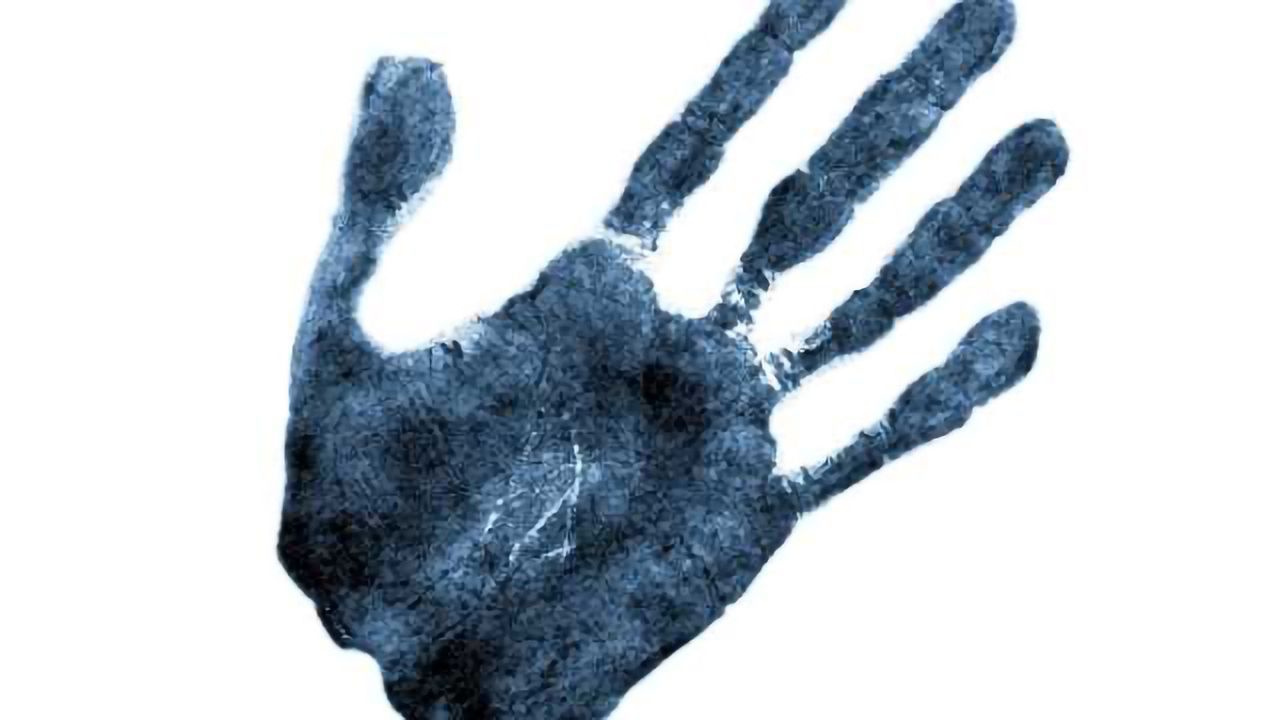 Rubber-hand illusion aids understanding of autism