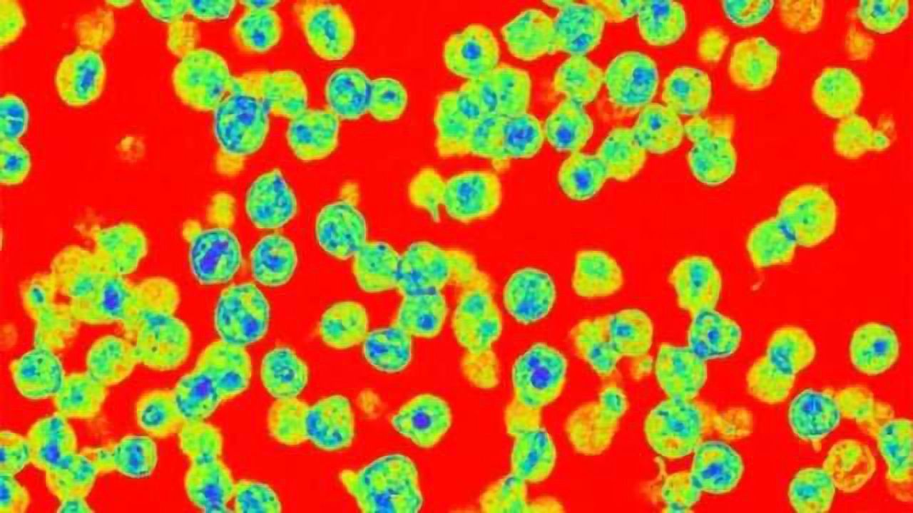 How HIV penetrates the blood-brain barrier