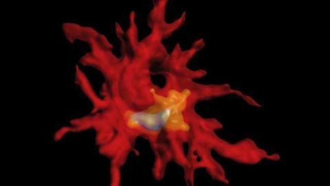 Immune cells harnessed to clear Alzheimer’s-associated plaques from rodent brains