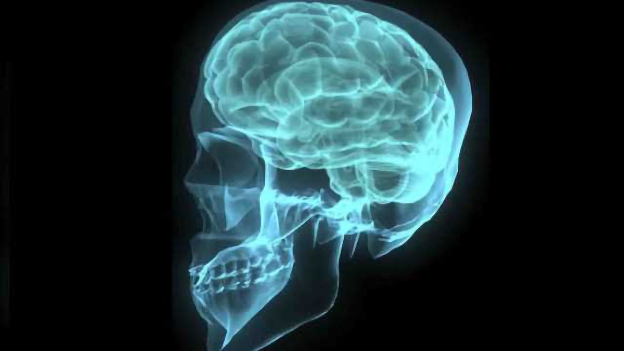 Different mental disorders cause same brain-matter loss, study finds