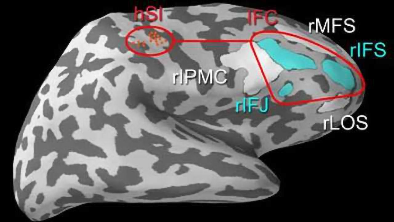 How the brain ignores distractions