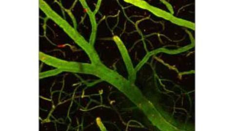 An “ambulance” for the brain