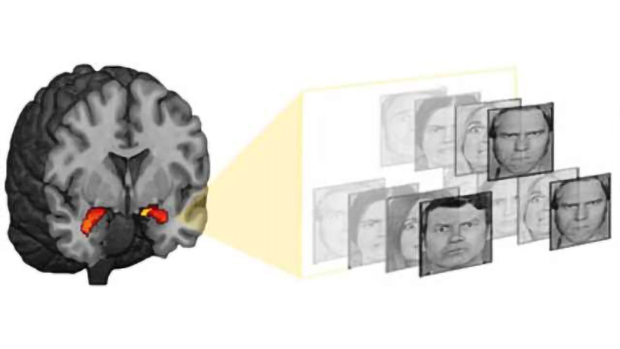 Brain Marker Hints at Depression, Anxiety Years Later