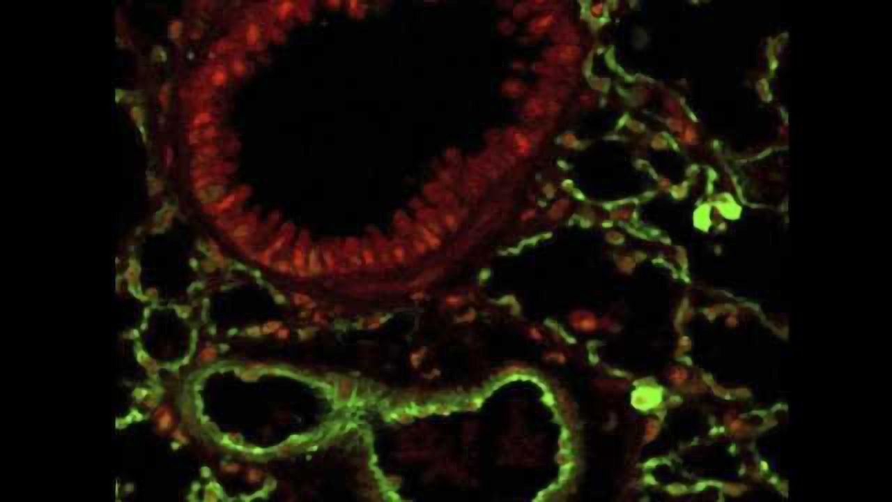 Research finds psychedelic drug prevents asthma development in mice