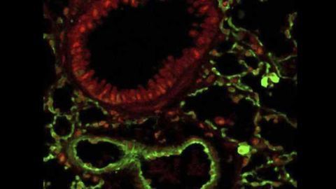 Research finds psychedelic drug prevents asthma development in mice