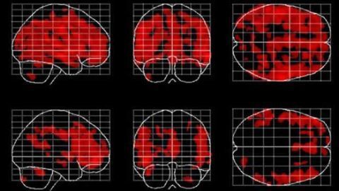 Forever young(er): Meditation might slow the age-related loss of gray matter in the brain
