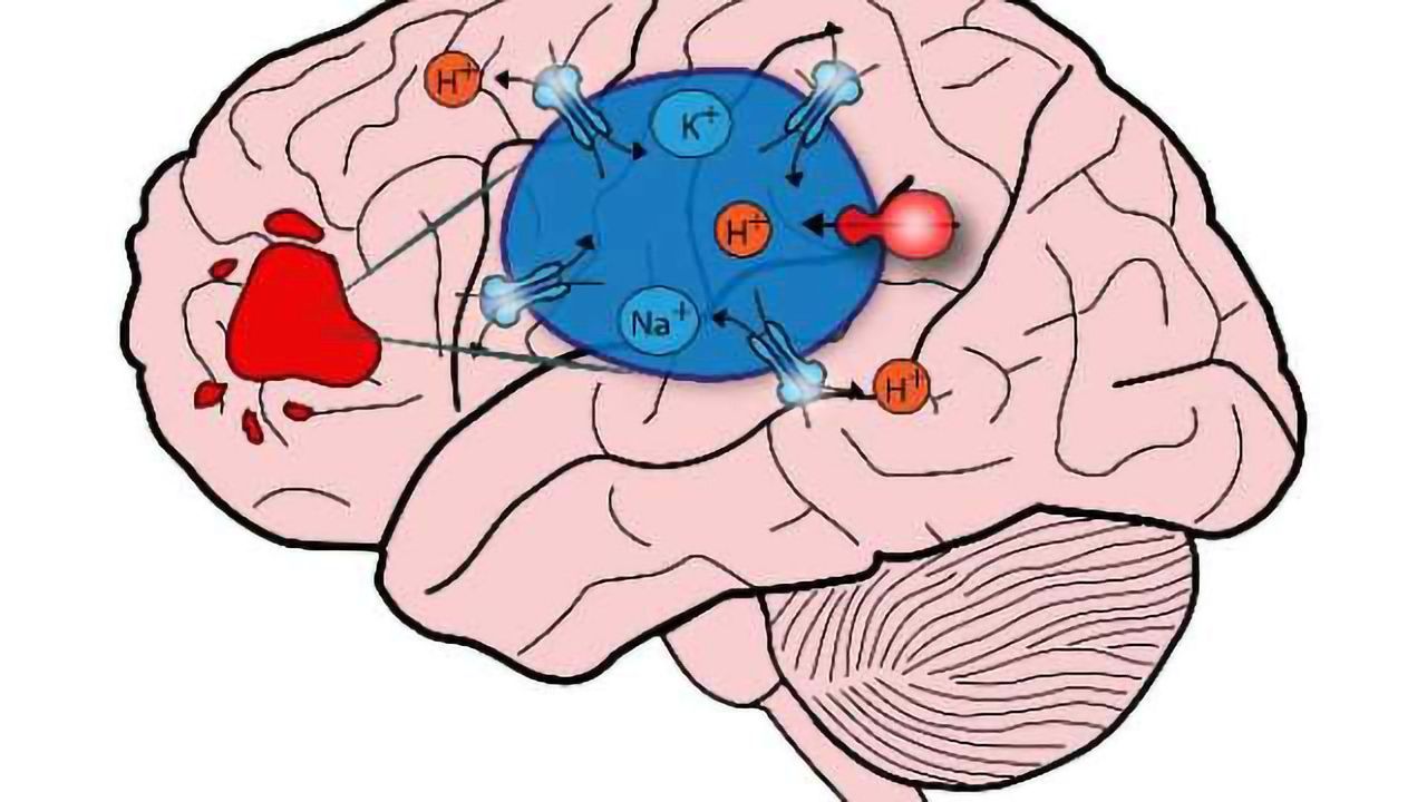 What Autism Can Teach Us About Brain Cancer