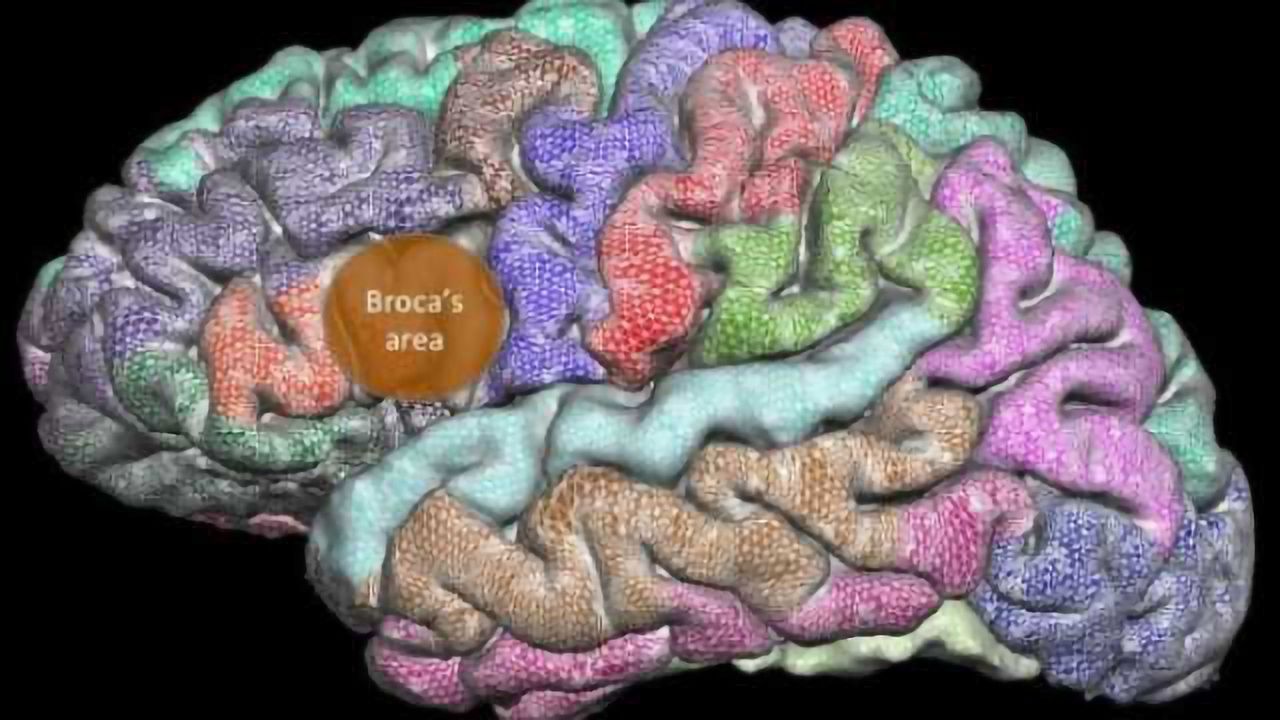 Brain develops abnormally over lifespan of people who stutter