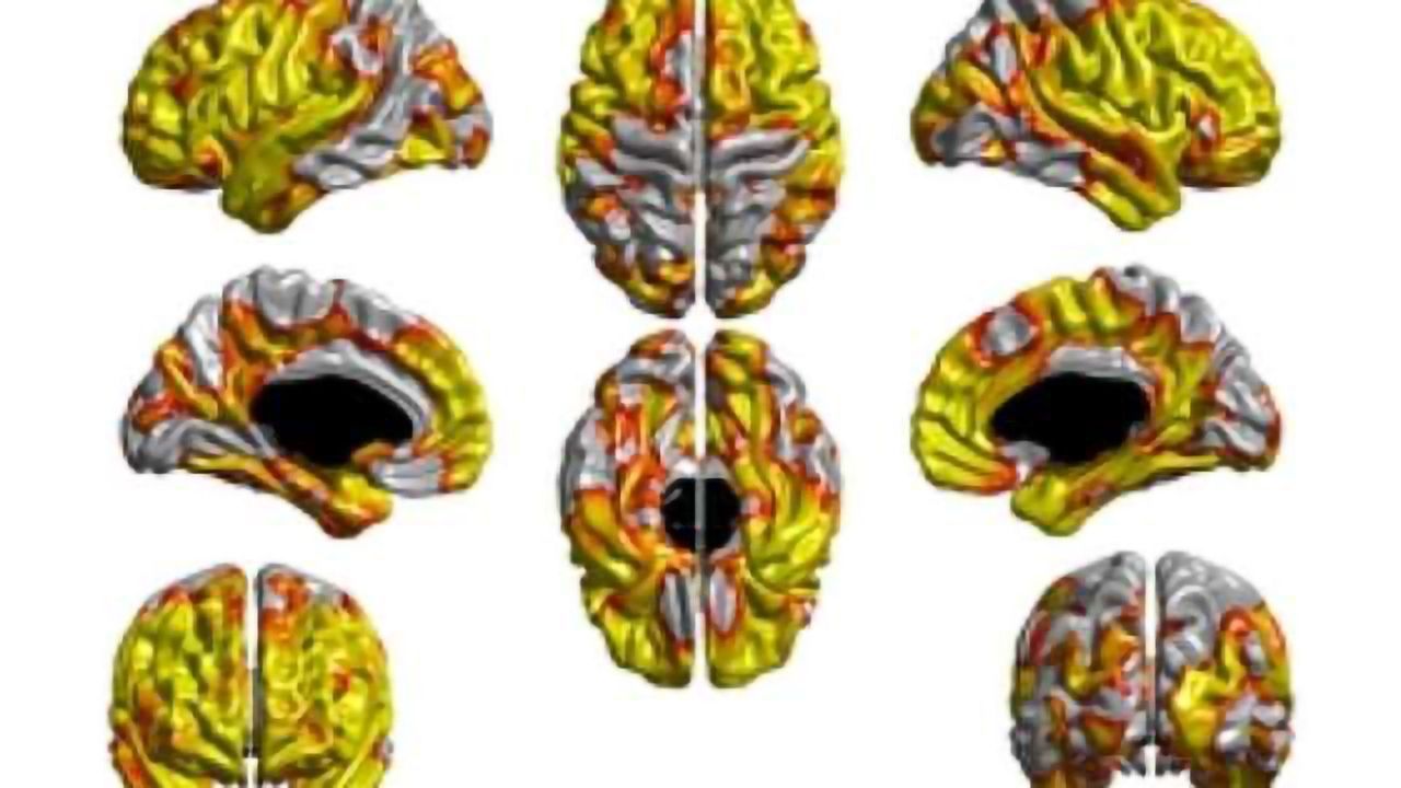 Smoking thins vital part of brain