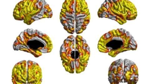Smoking thins vital part of brain