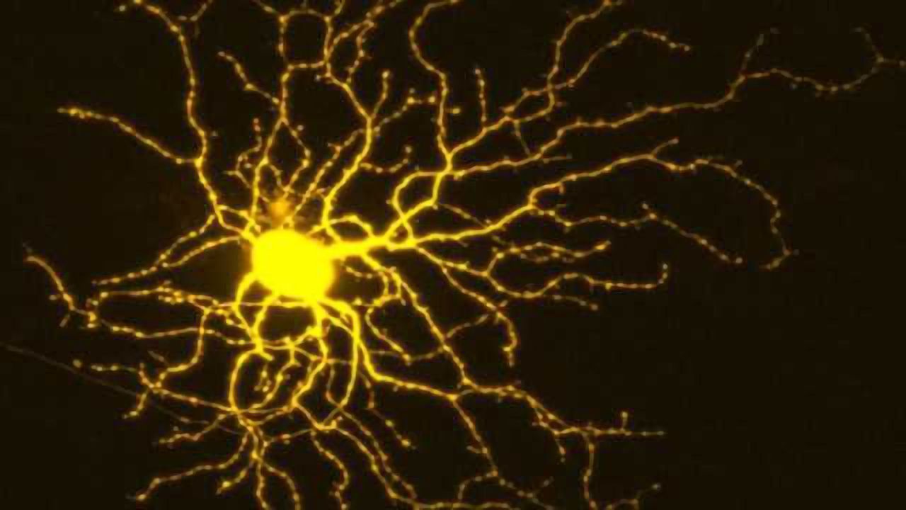 Early retina cell changes in glaucoma identified