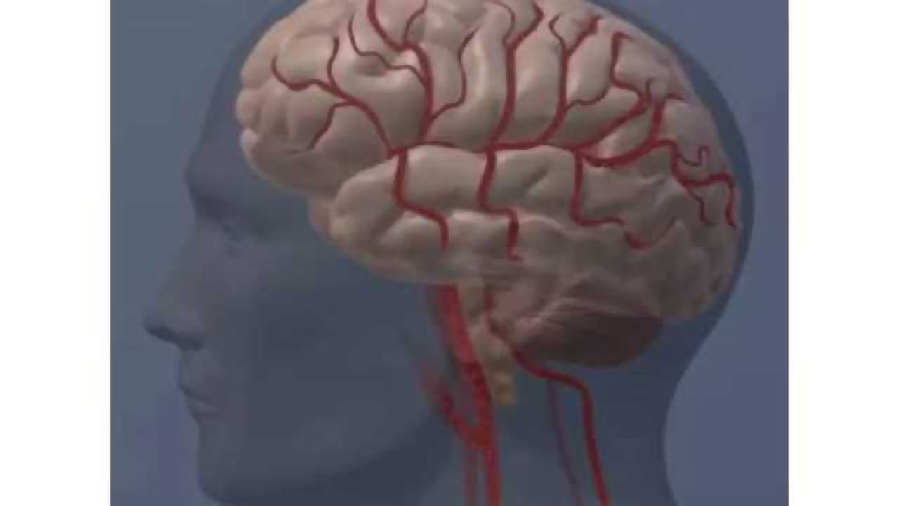 New device improves healing of some ruptured aneurysms