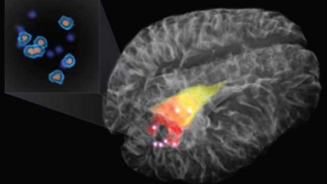 Revolutionary new probe zooms in on cancer cells