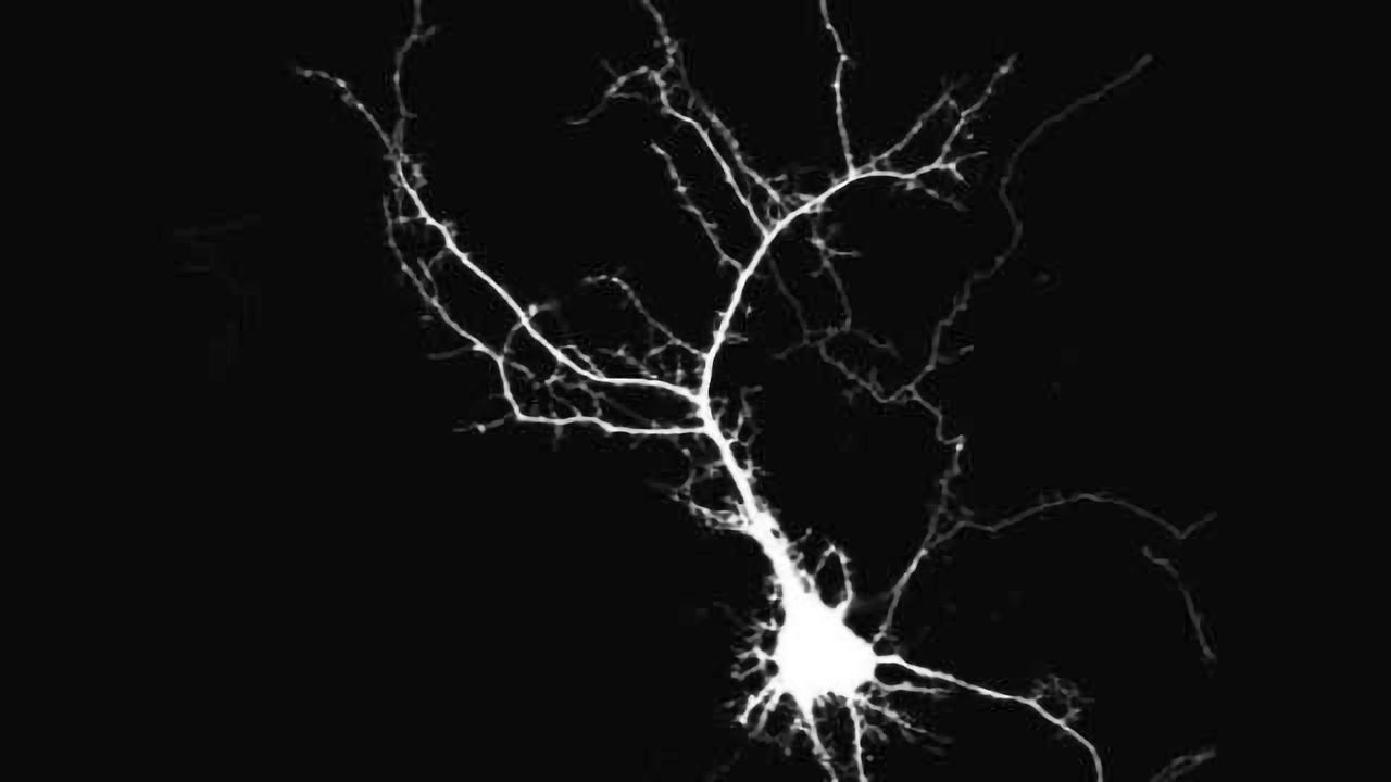 Spontaneous activity shapes neuron development