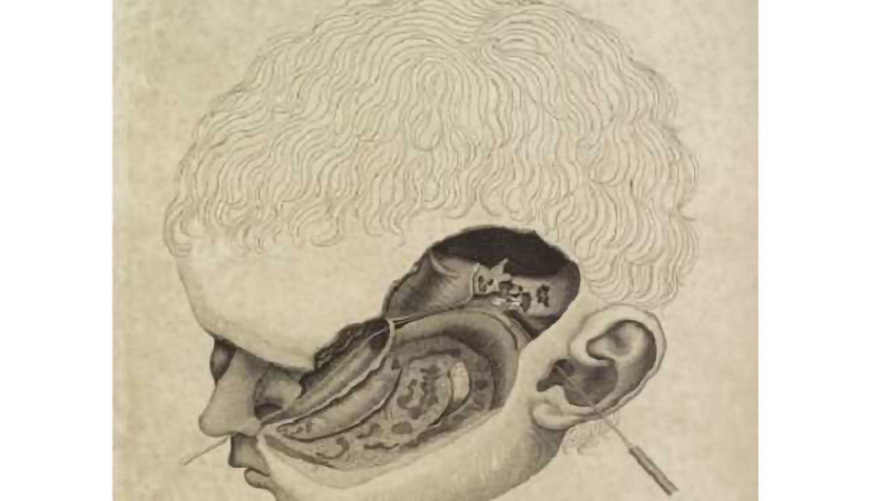 Hearing experts break sound barrier for children born without hearing nerve