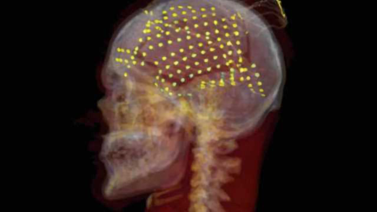 Brain’s iconic seat of speech goes silent when we actually talk