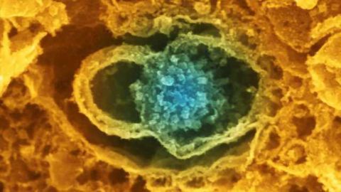 New insights into underlying cellular mechanisms of information processing in the brain
