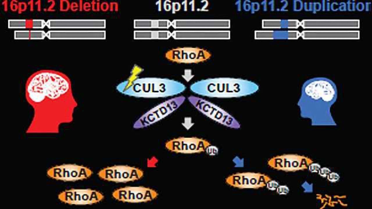 Autism Genes Activate During Fetal Brain Development