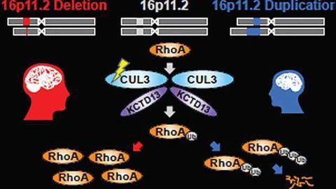 Autism Genes Activate During Fetal Brain Development