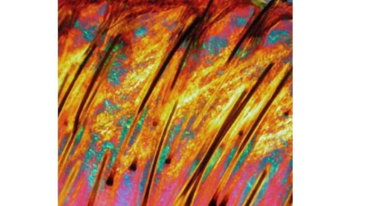 Chicken Pox Virus May Be Linked to Serious Condition in the Elderly