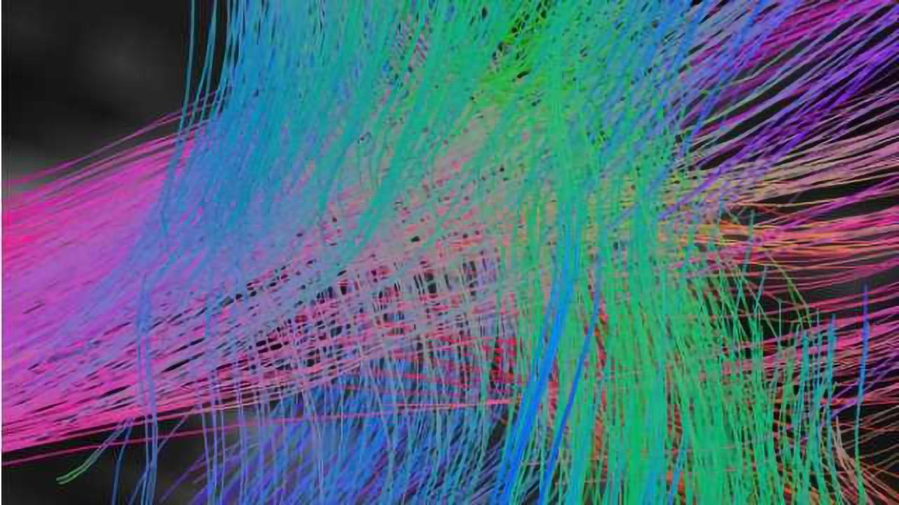 New insights on stuttering treatment