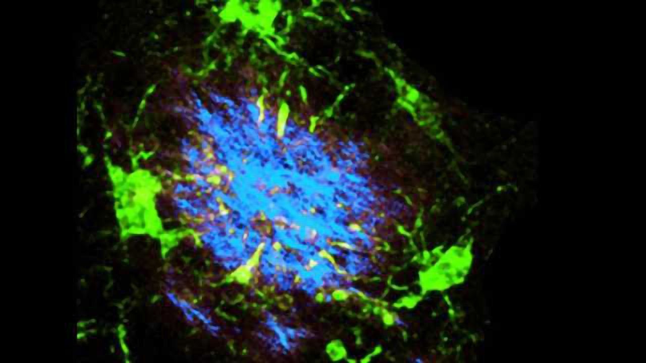 New target identified in fight against Alzheimer’s, multiple sclerosis