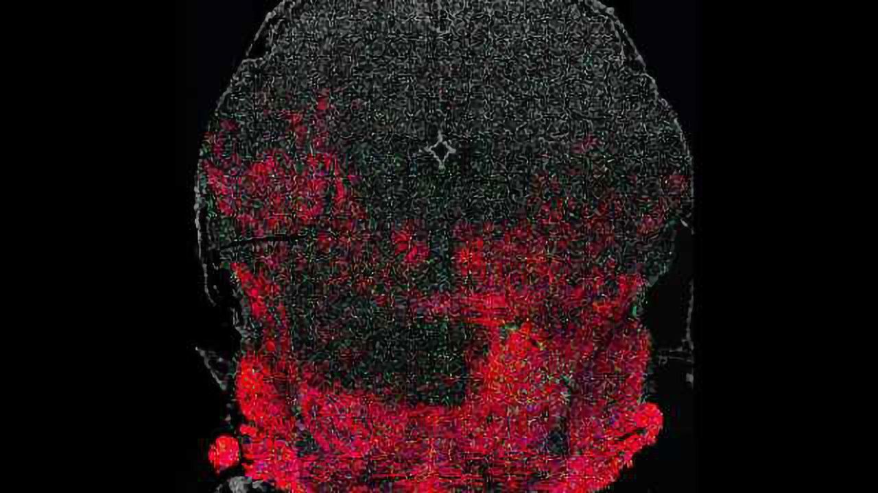 Myelin-maker: How an FDA-approved drug boosts myelin synthesis