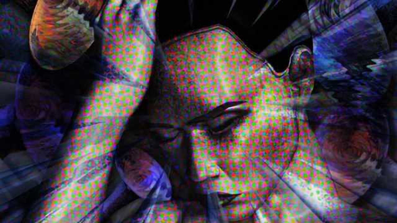 Image-guided treatment shown to break the migraine cycle