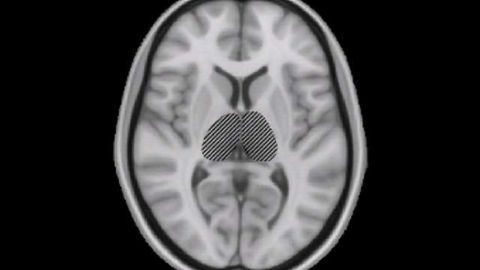 Neuron Groups, Not Single Cells, Maintain Brain Stability
