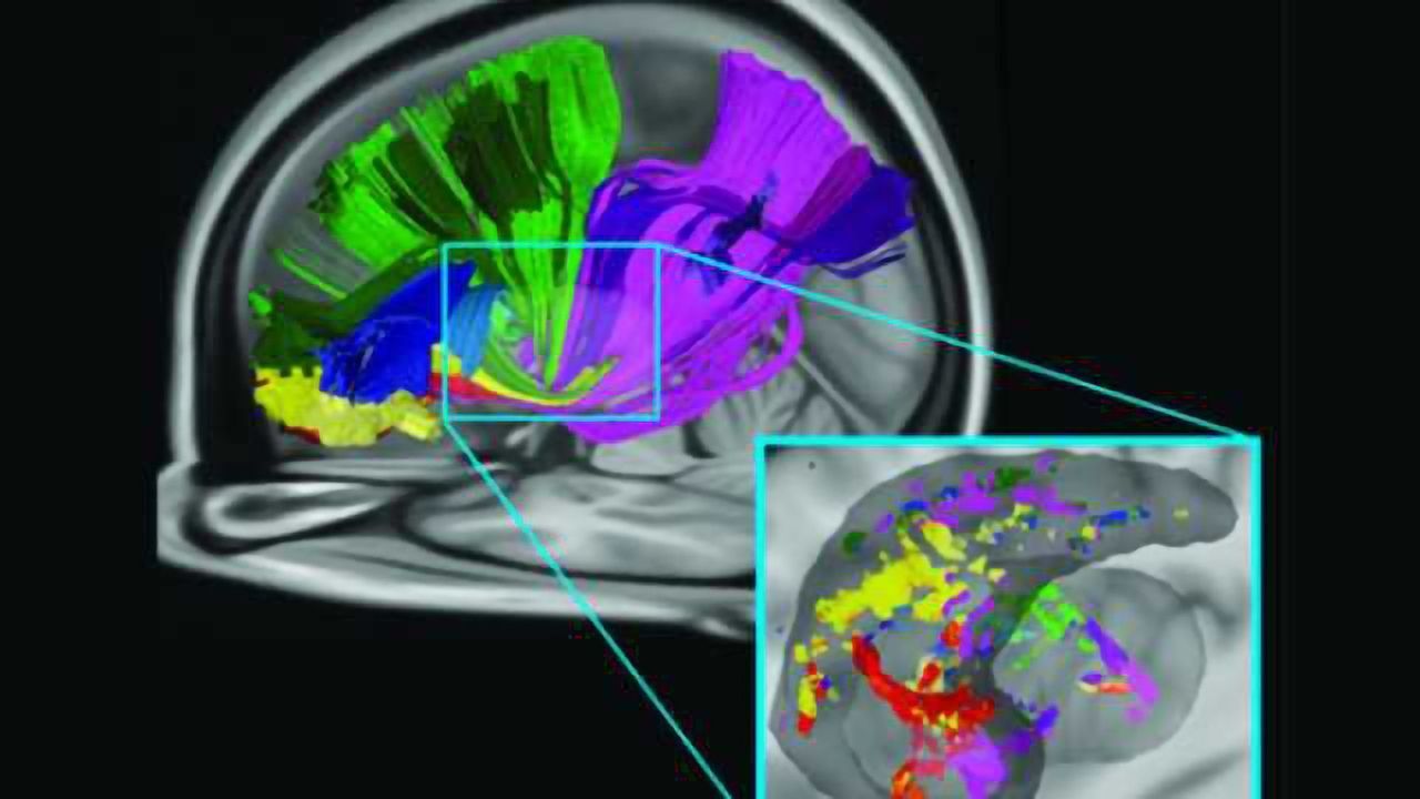 New way several brain areas communicate identified