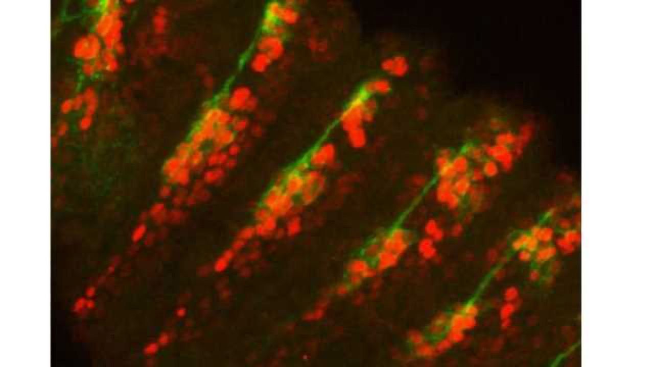 Using Fruit Flies to Understand How We Sense Hot and Cold