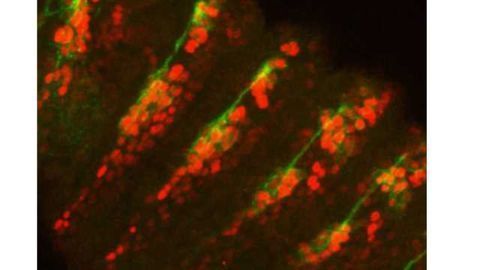 Using Fruit Flies to Understand How We Sense Hot and Cold