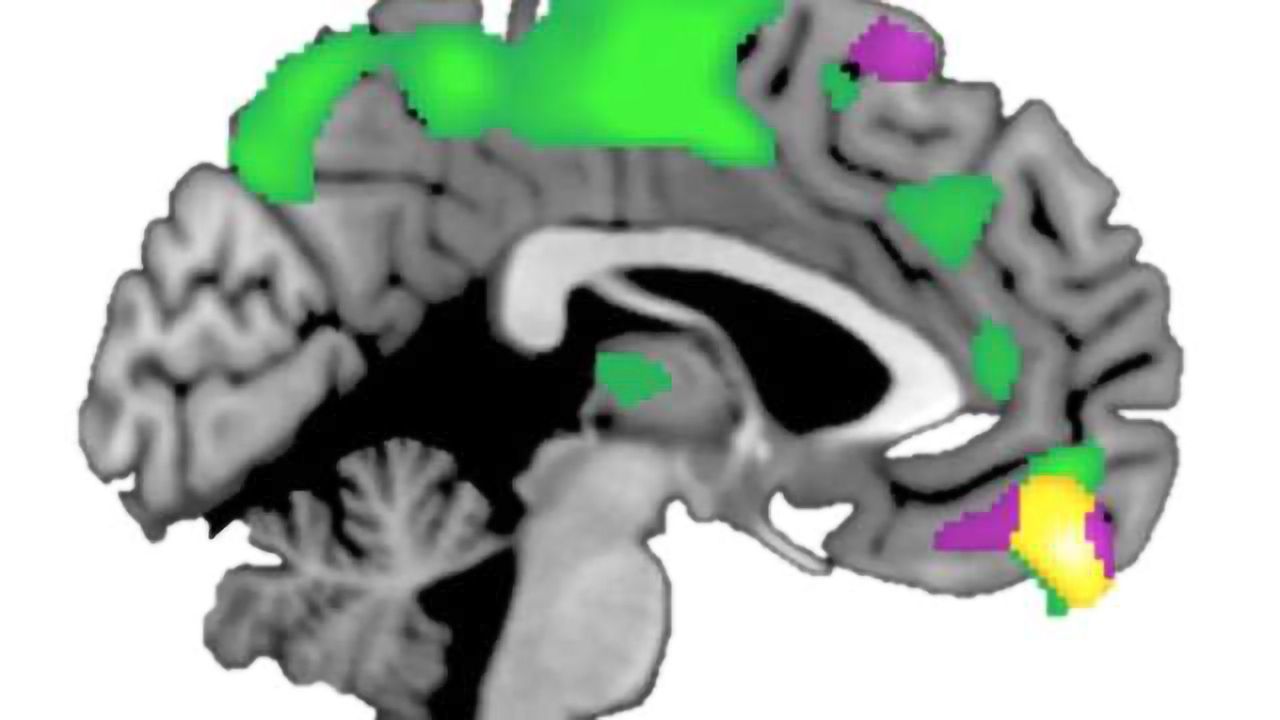 Brain structure varies depending on how trusting people are of others, study shows