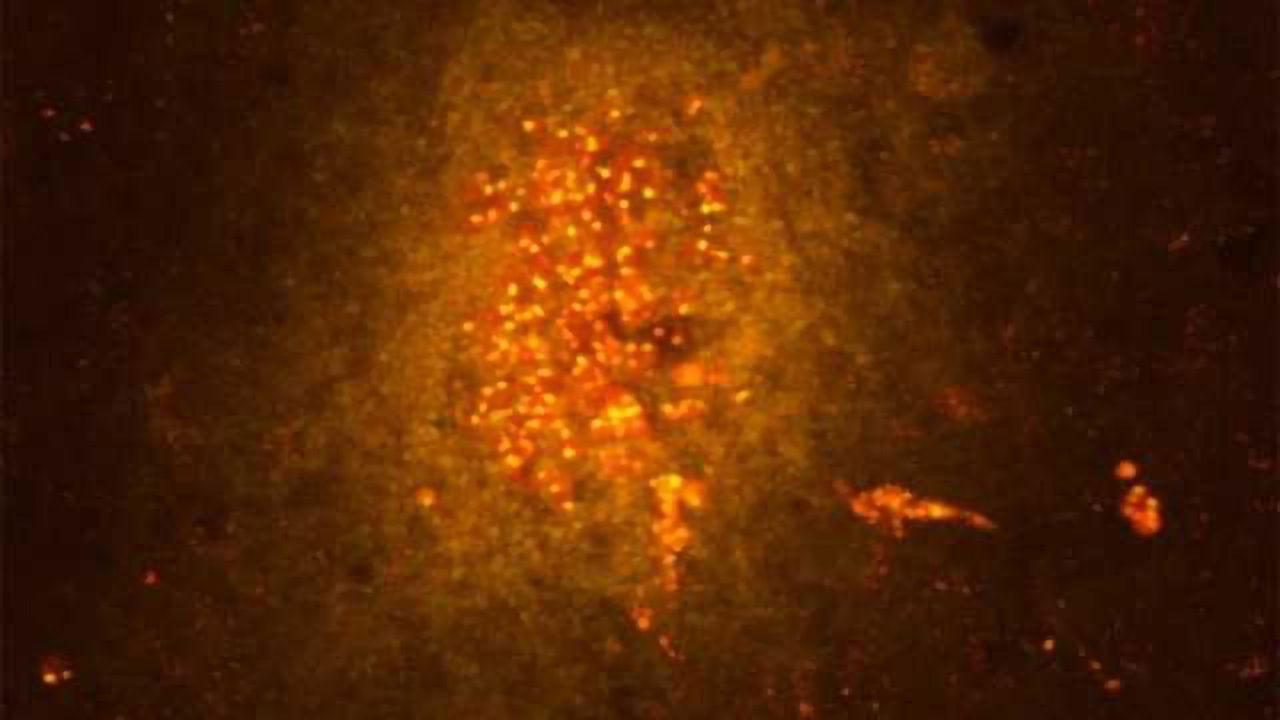 New findings on 'key players' in brain inflammation