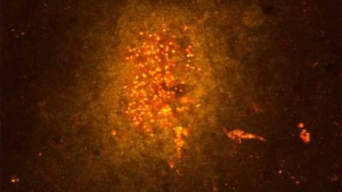 New findings on 'key players' in brain inflammation
