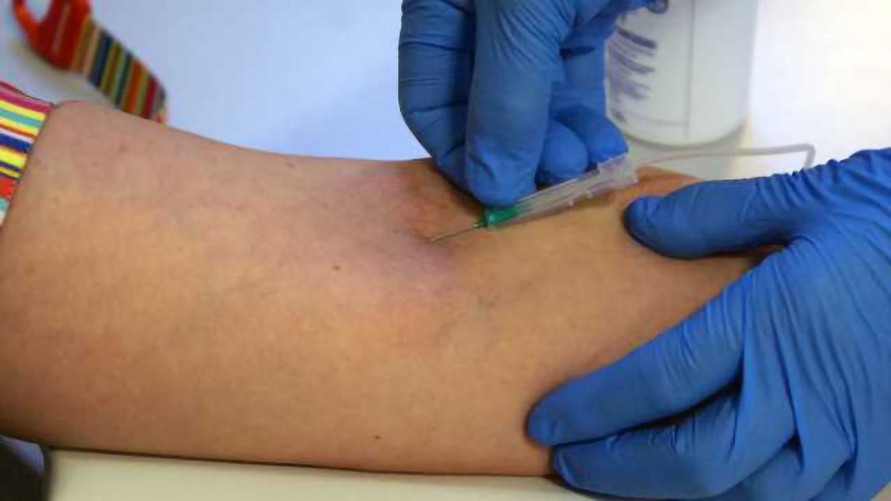 Blood-based genetic biomarkers identify young boys with autism