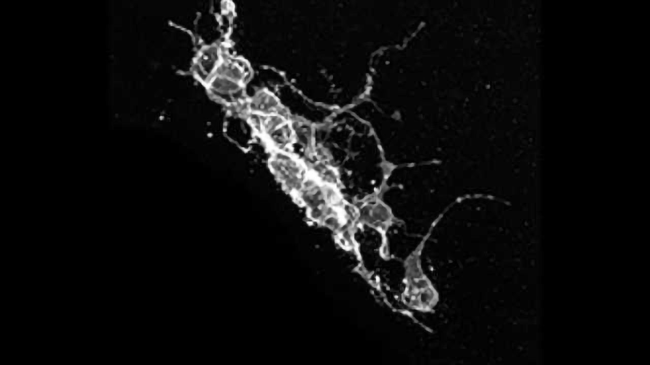 Stem cells in the brain: Limited self-renewal