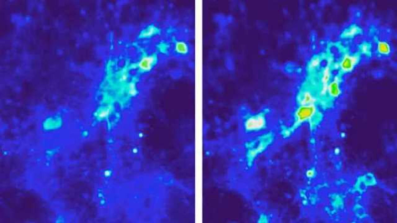 Advances in deep brain stimulation: magnetic fields and nanoparticles