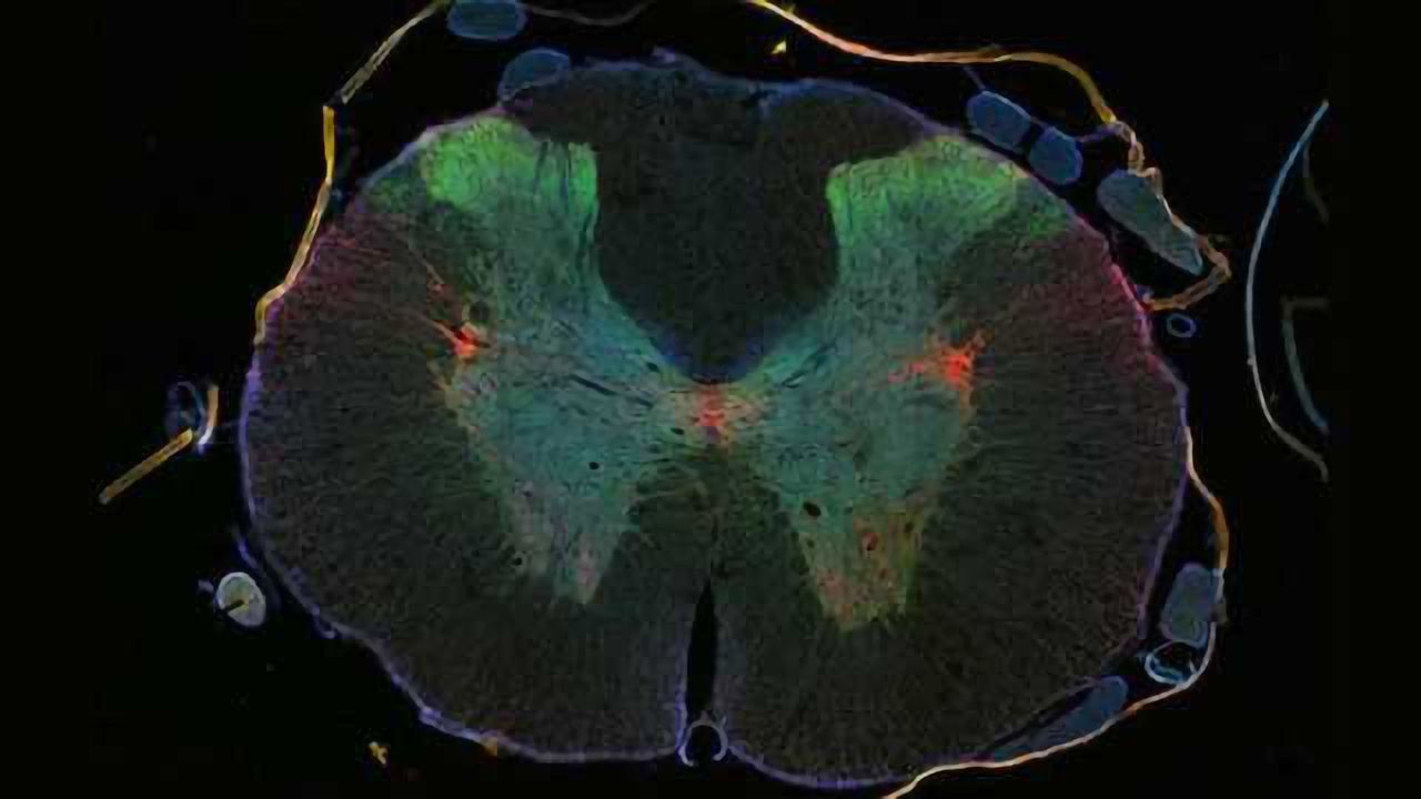 Regeneration in a hostile environment: cancer drug promotes regeneration of damaged neurons