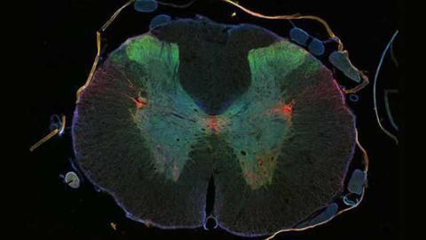 Regeneration in a hostile environment: cancer drug promotes regeneration of damaged neurons