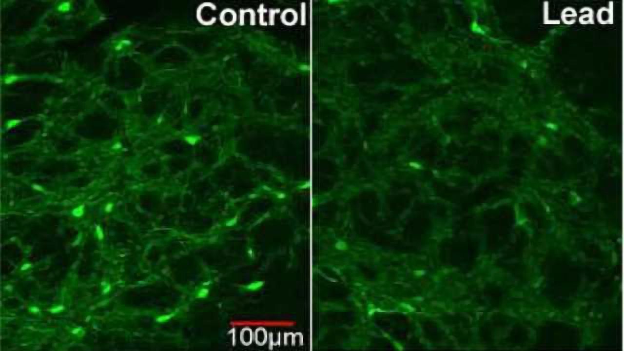 Rat brains point to lead's role in schizophrenia