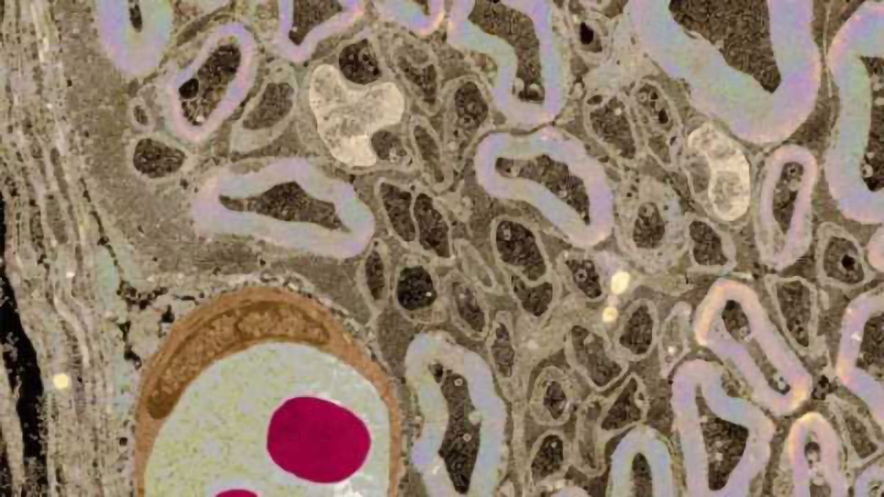 Blood Pressure Drug Protects Against Symptoms of Multiple Sclerosis in Animal Models