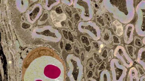 Blood Pressure Drug Protects Against Symptoms of Multiple Sclerosis in Animal Models