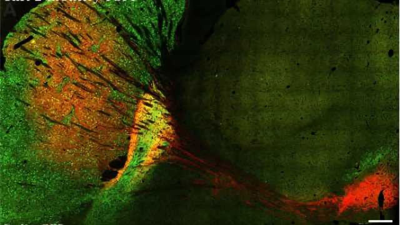 Research Explores Dark Neural Patches