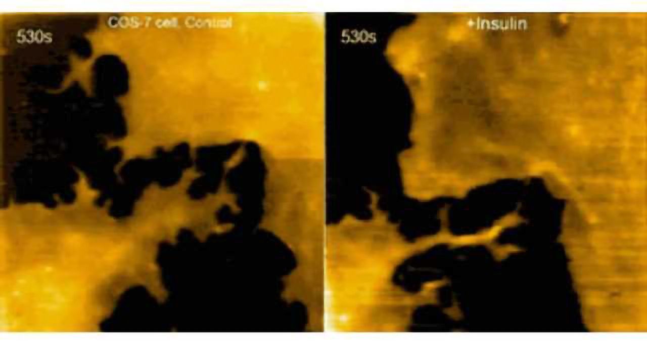 Atomic force microscopy for imaging nanoscale dynamics of neurons