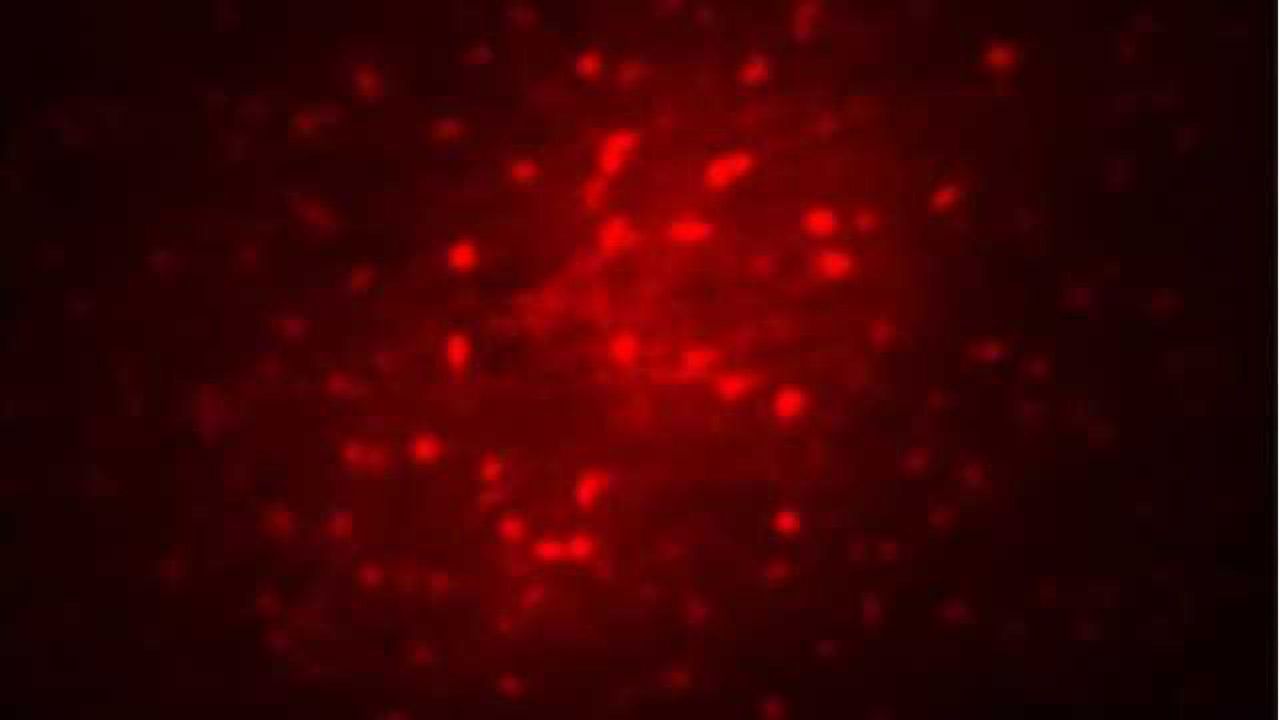Fatal uncoupling in the epileptic brain