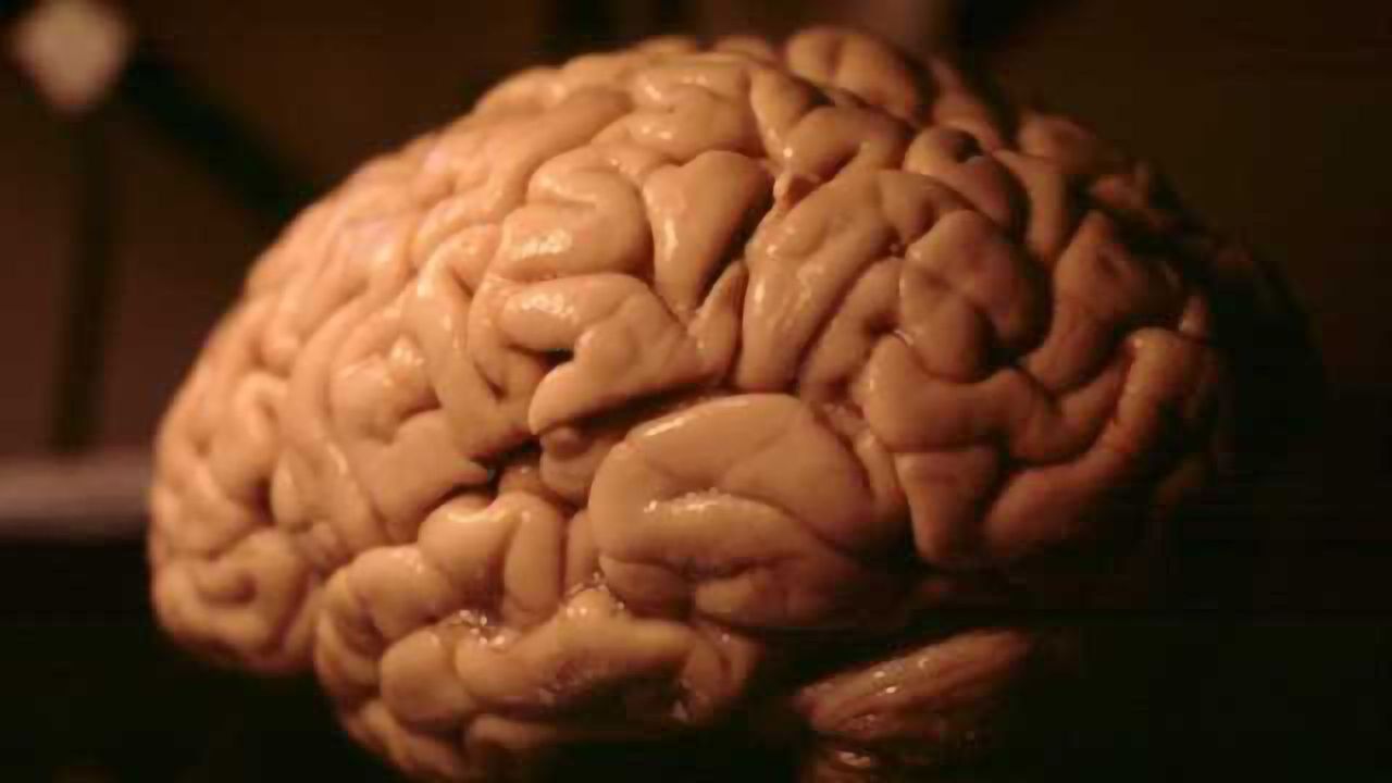 Surprising finding made in stroke research