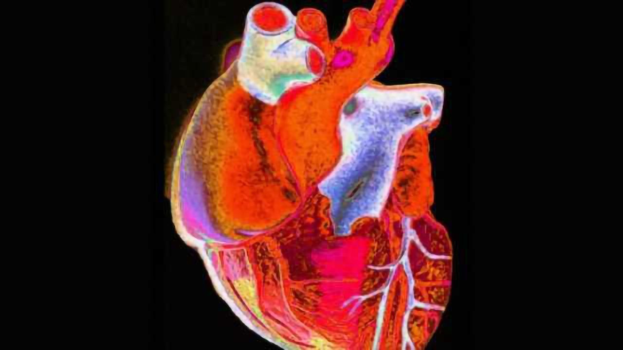 New device that protects the brain during heart-valve procedure tested