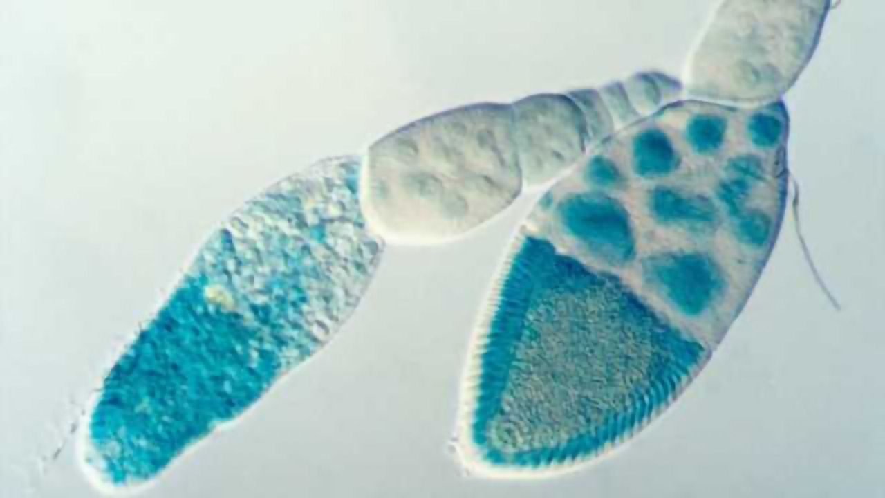 Microscope technique reveals for first time when and where proteins are made